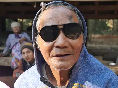 A patient wearing protective glasses after receiving eye care